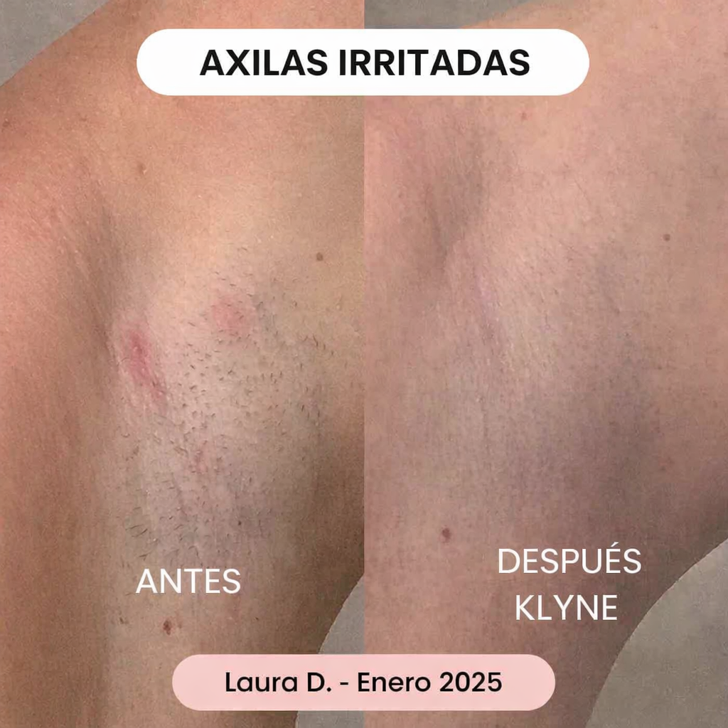 LumiSkin™ – Depiladora con doble cabezal 2 en 1✨