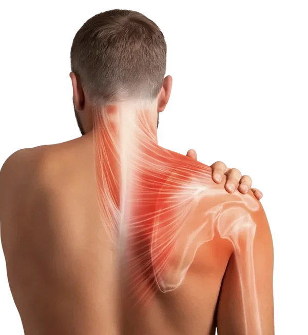 El dolor de hombro te limita a diario.